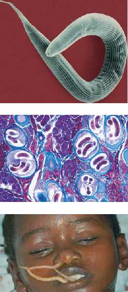 nematoda breathing