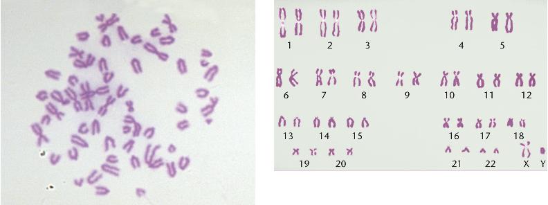 karyotype male. This is a human male karyotype