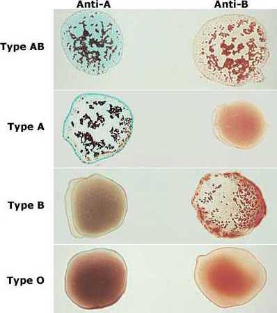 agglutination