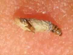 (Dahlica Bagworm Moth) caterpillar (Dahlica Bagworm Moth) caterpillar